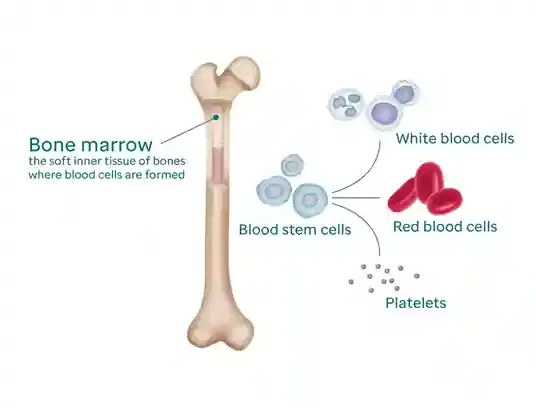Autologous Bone Marrow / Stem Cell Transplant