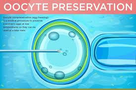 Egg Freezing (Oocyte Cryopreservation)