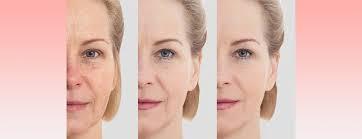 Facelift & Anti-Aging Procedures