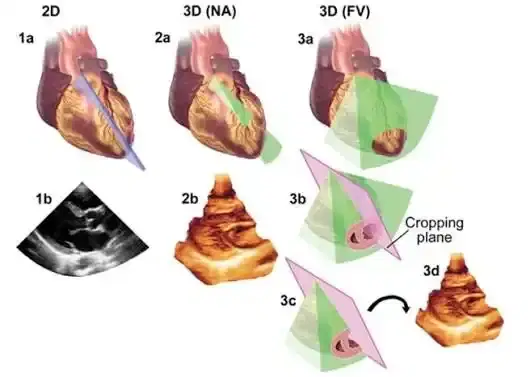 Echocardiography (2D / 3D / TEE)