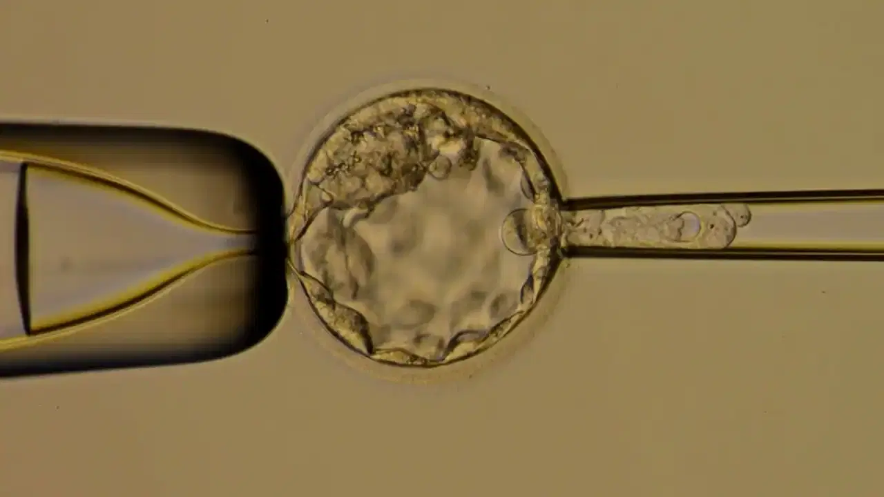 embryo biopsy