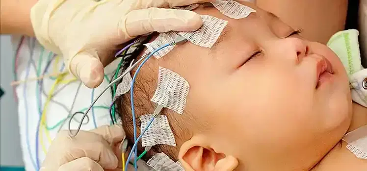 Paediatric Neurology