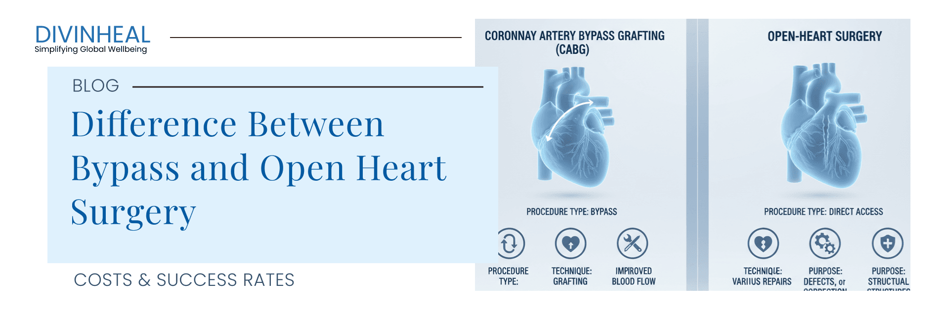 Difference Between Bypass and Open Heart Surgery - Image 1