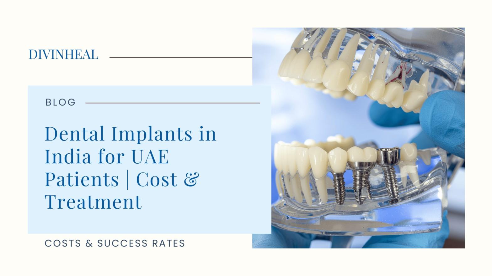 Dental Implants in India for UAE Patients | Cost & Treatment - Image 1