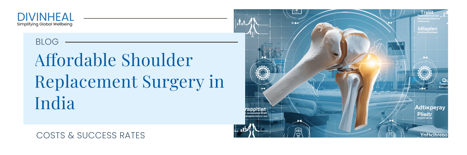 Affordable Shoulder Replacement Surgery in India - Image 1
