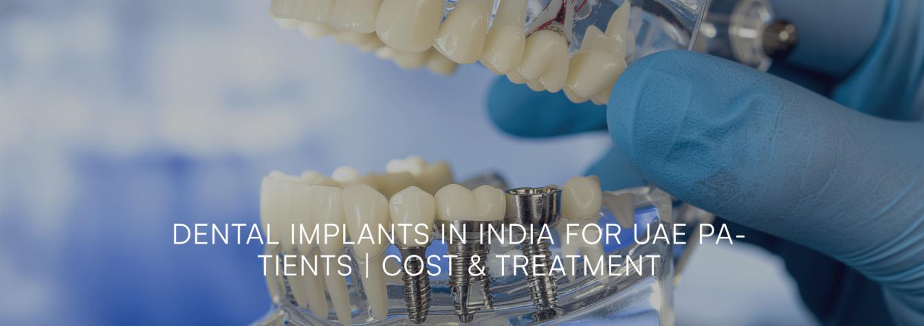 Dental Implants in India for UAE Patients | Cost & Treatment - Image 1