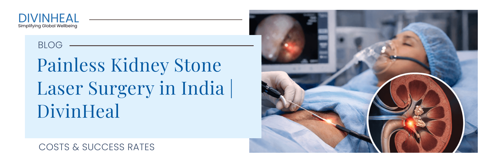 Painless Kidney Stone Laser Surgery in India | DivinHeal - Image 1