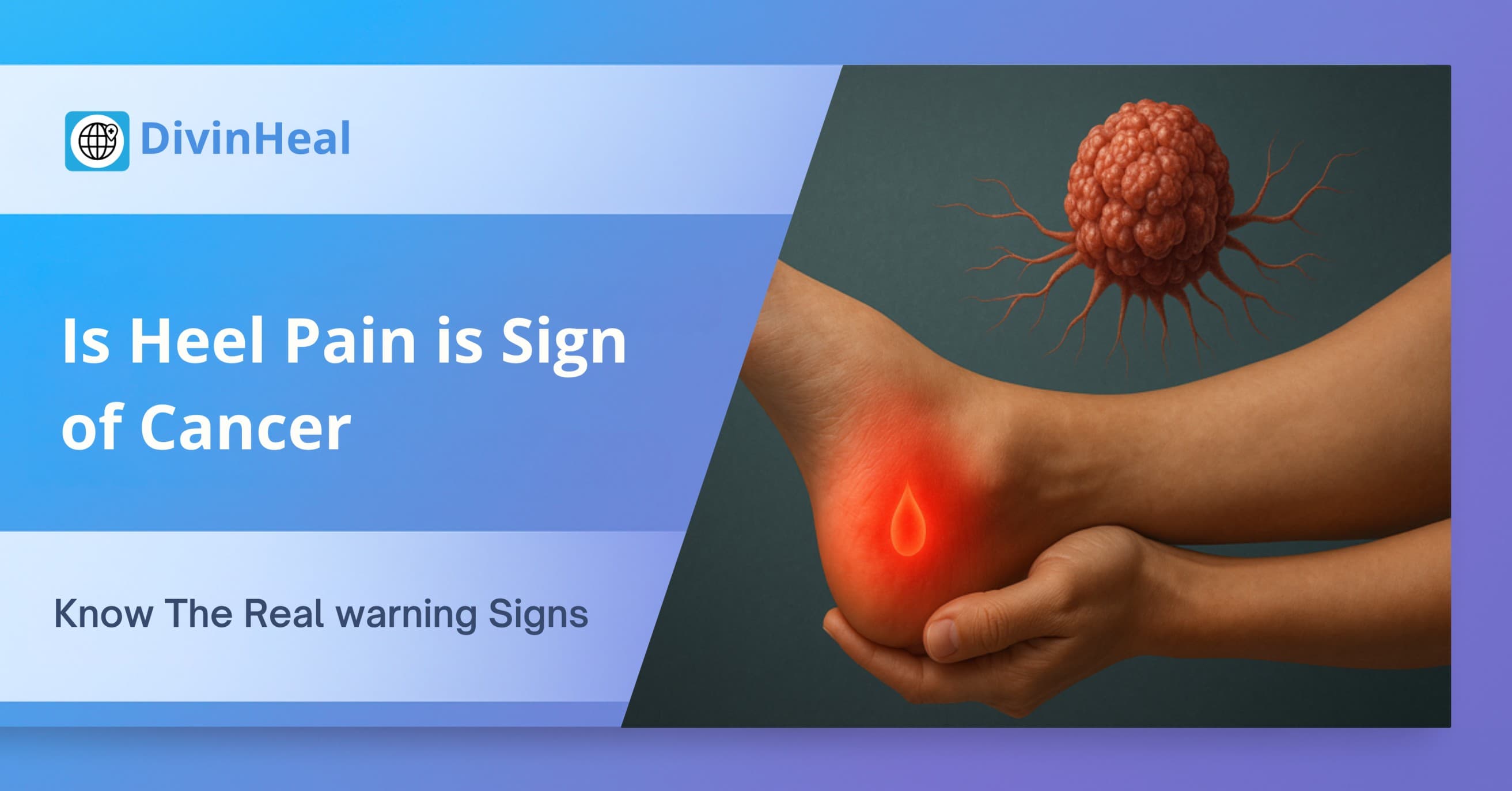 Is heel pain: a sign of cancer?