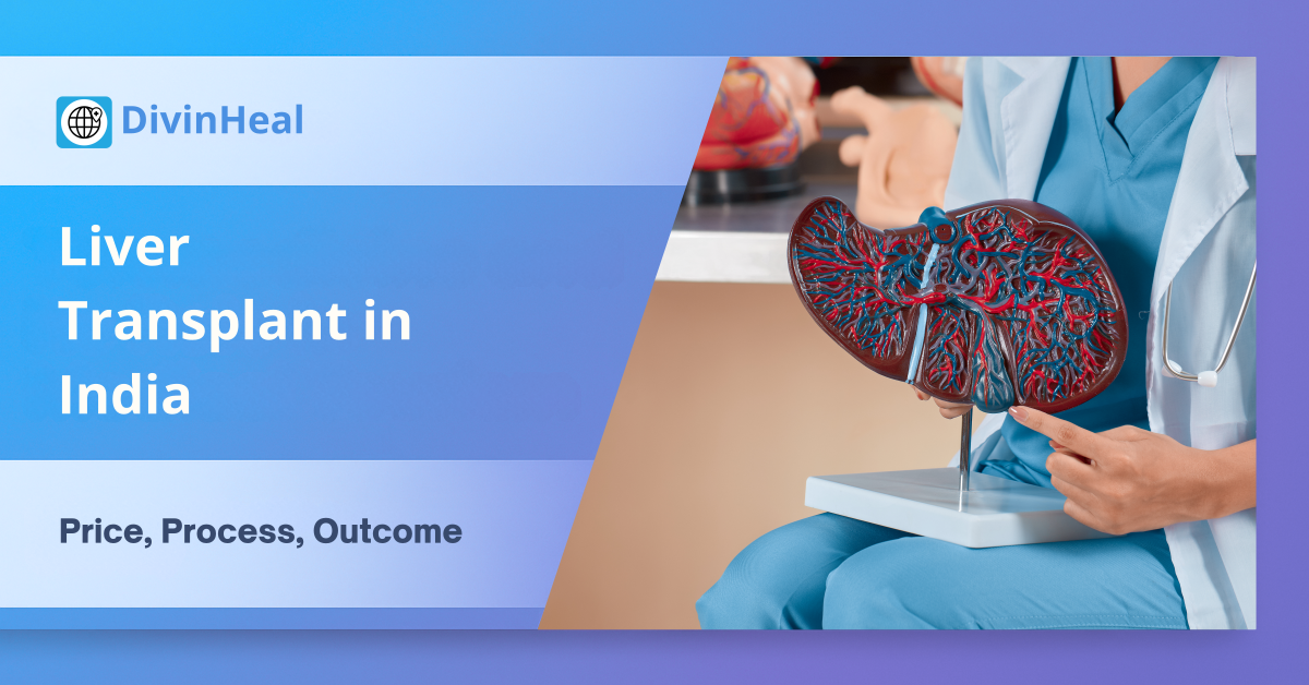 Liver Transplant Cost in India: Affordable Surgery & Charges