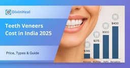 Teeth Veneers Cost in India 2025 | Price, Types & Guide