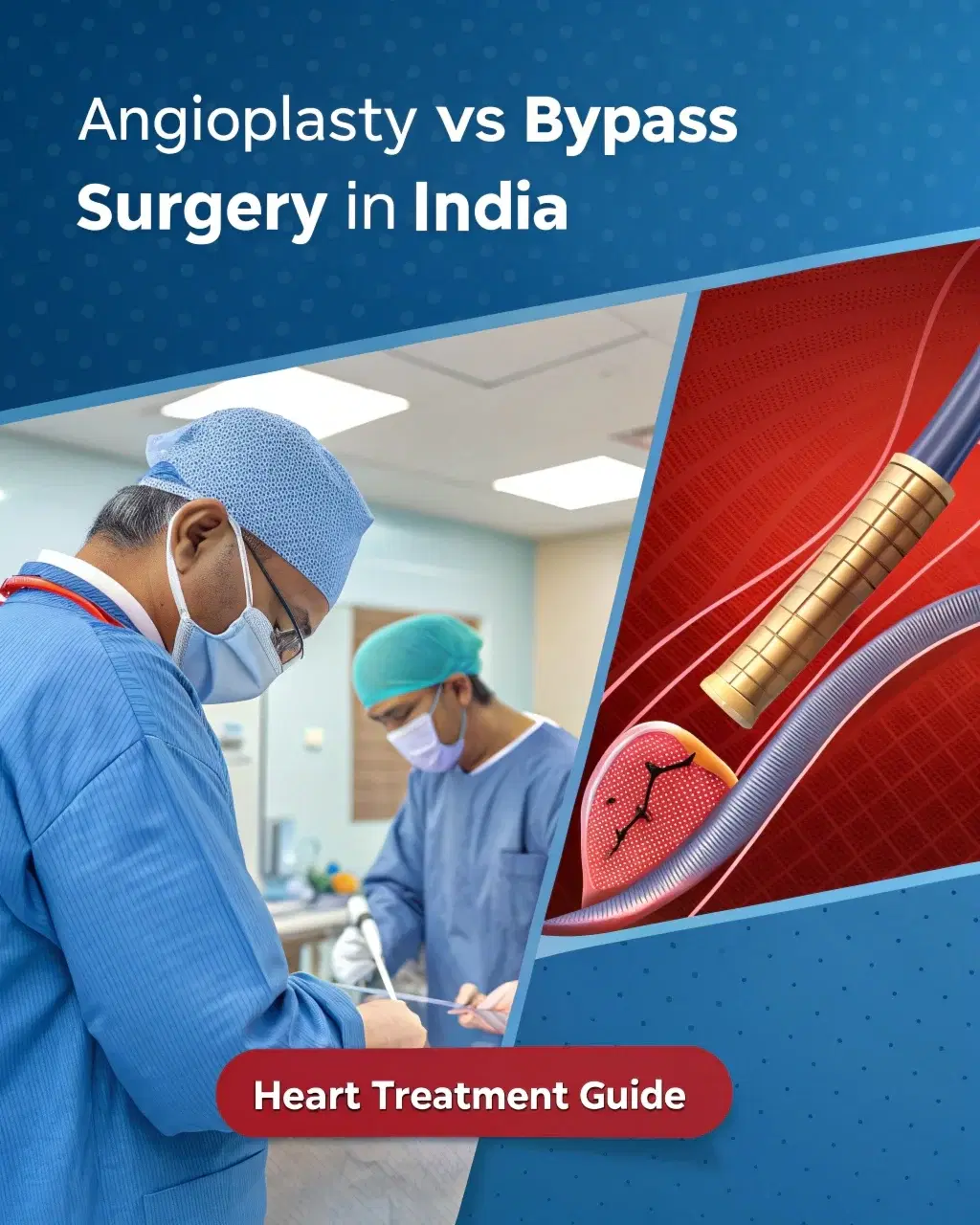 Angioplasty vs Bypass Surgery in India | Heart Treatment Guide