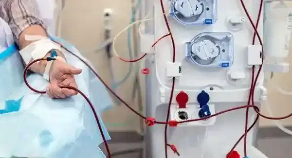 Plasmapheresis Plasmapheresis