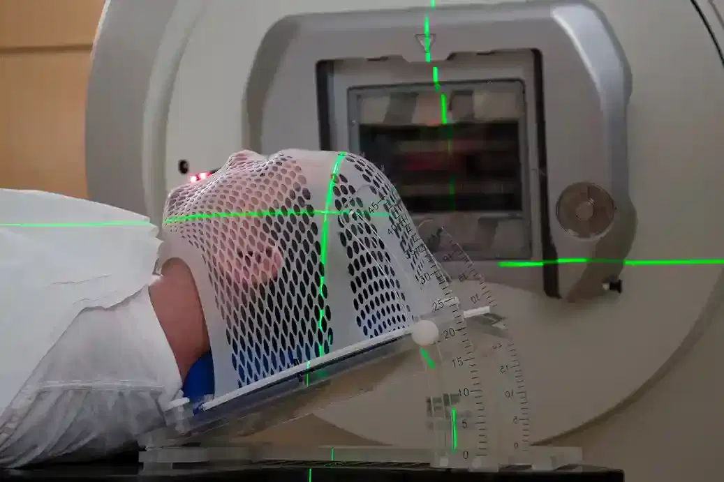 radiation therapy cancer radiation therapy cancer