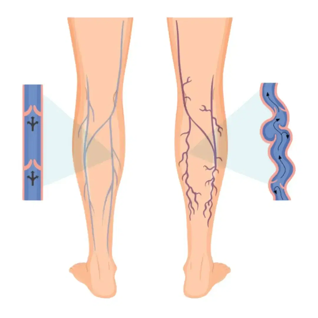 Vascular Surgery Vascular Surgery