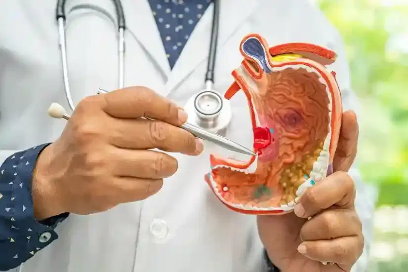 stomach cancer surgery stomach cancer surgery