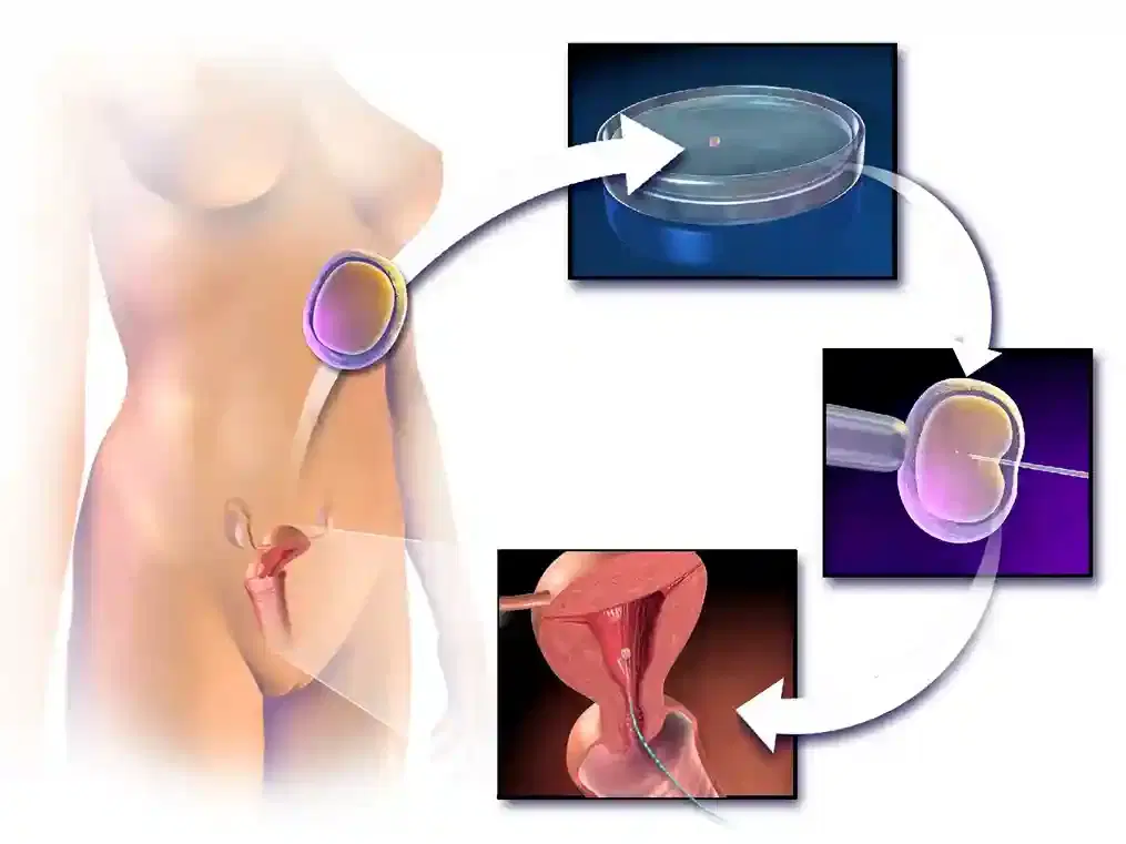 assisted reproduction assisted reproduction