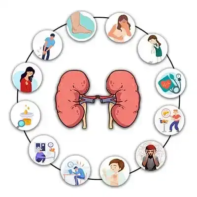 Chronic Kidney Disease (CKD) Management Program Chronic Kidney Disease (CKD) Management Program