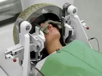 Gamma Knife Radiosurgery Gamma Knife Radiosurgery