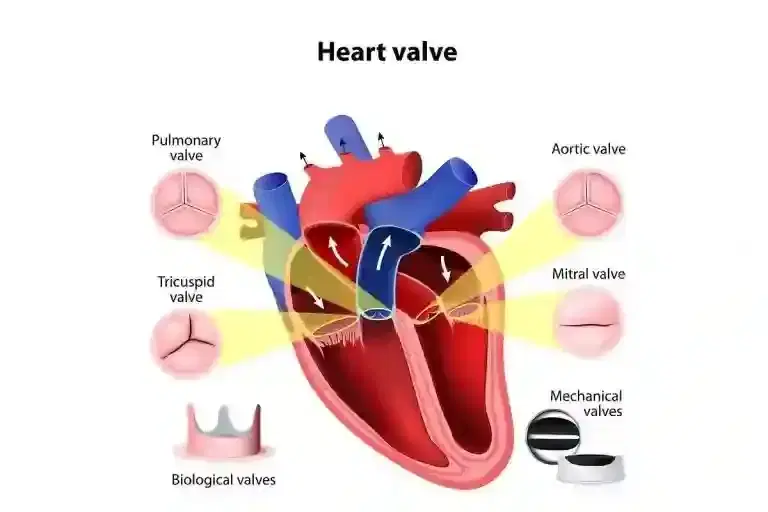 heart valve surgery heart valve surgery