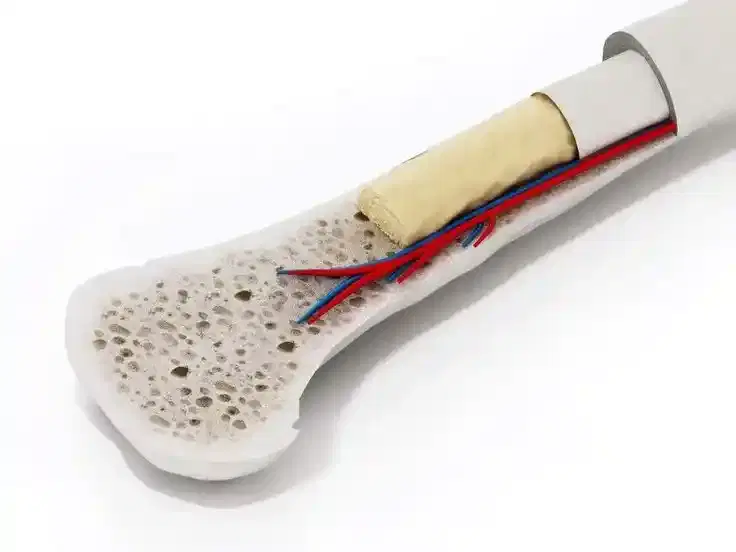 Allogeneic Bone Marrow / Stem Cell Transplant Allogeneic Bone Marrow / Stem Cell Transplant