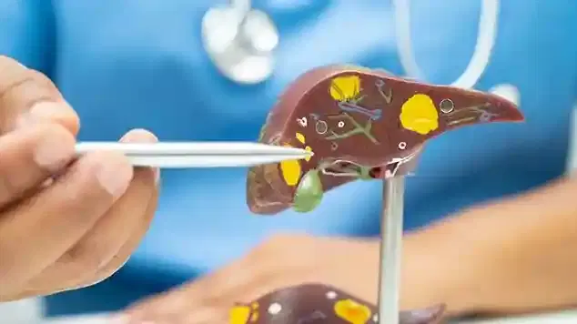 NAFLD Management NAFLD Management