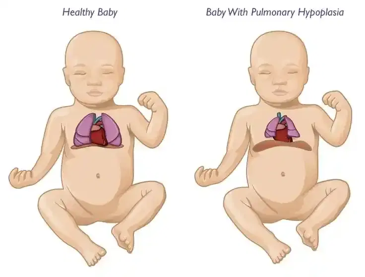 Pediatric Pulmonology Pediatric Pulmonology
