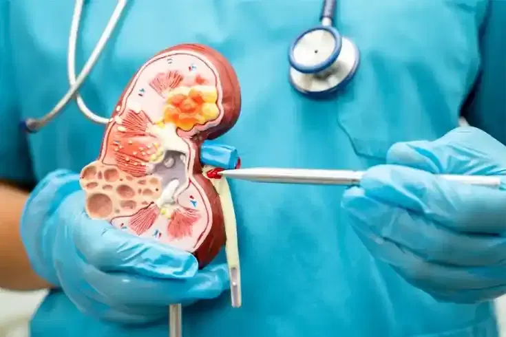 Nephrology Nephrology