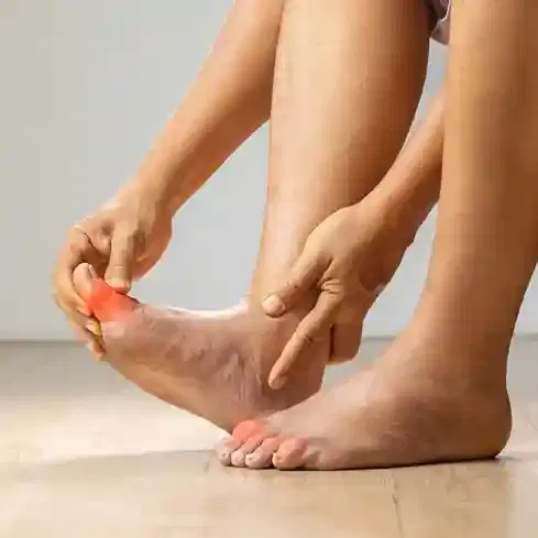 Gout Management Gout Management