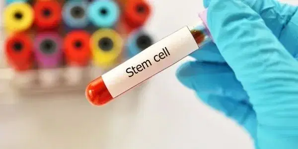 stem cell transplant cancer stem cell transplant cancer