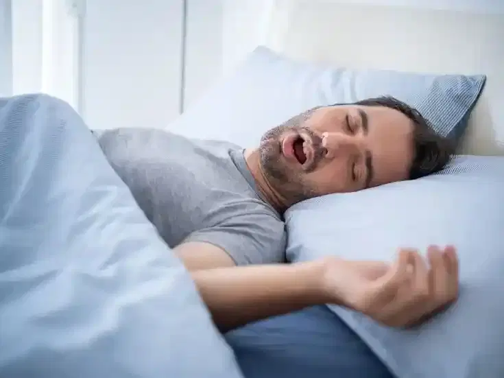 Sleep Apnea Study Sleep Apnea Study
