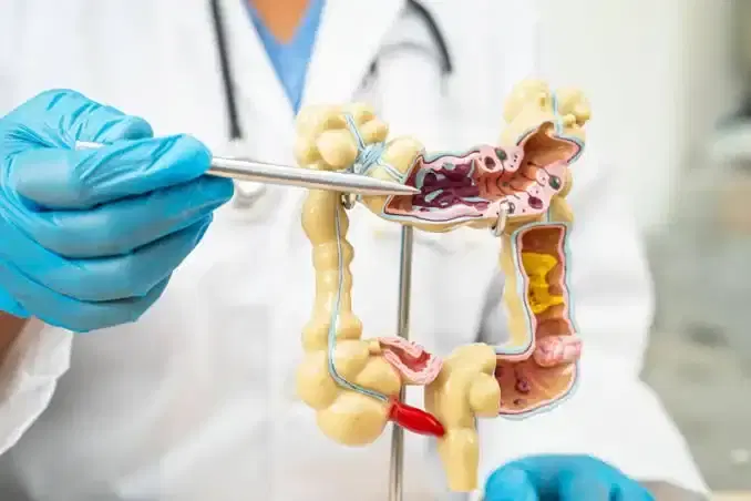colorectal cancer surgery colorectal cancer surgery