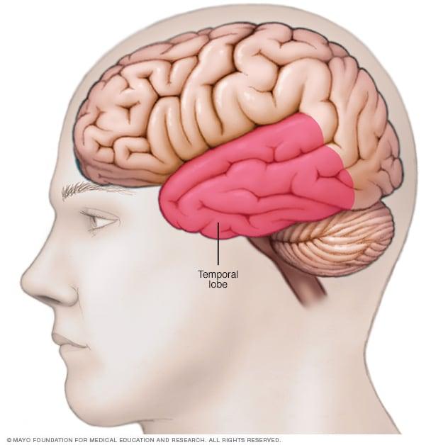 Pediatric Epilepsy Surgery